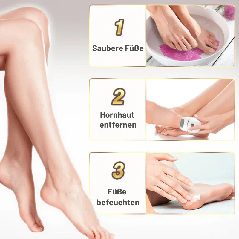 LoungeYard | SmoothEase – Silky Feet in Minutes! — product view 4